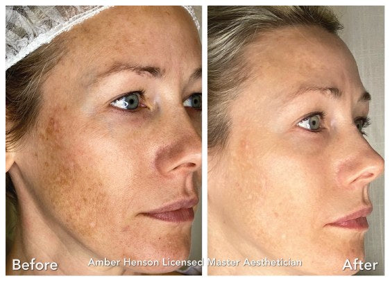 Before and after, second angle
