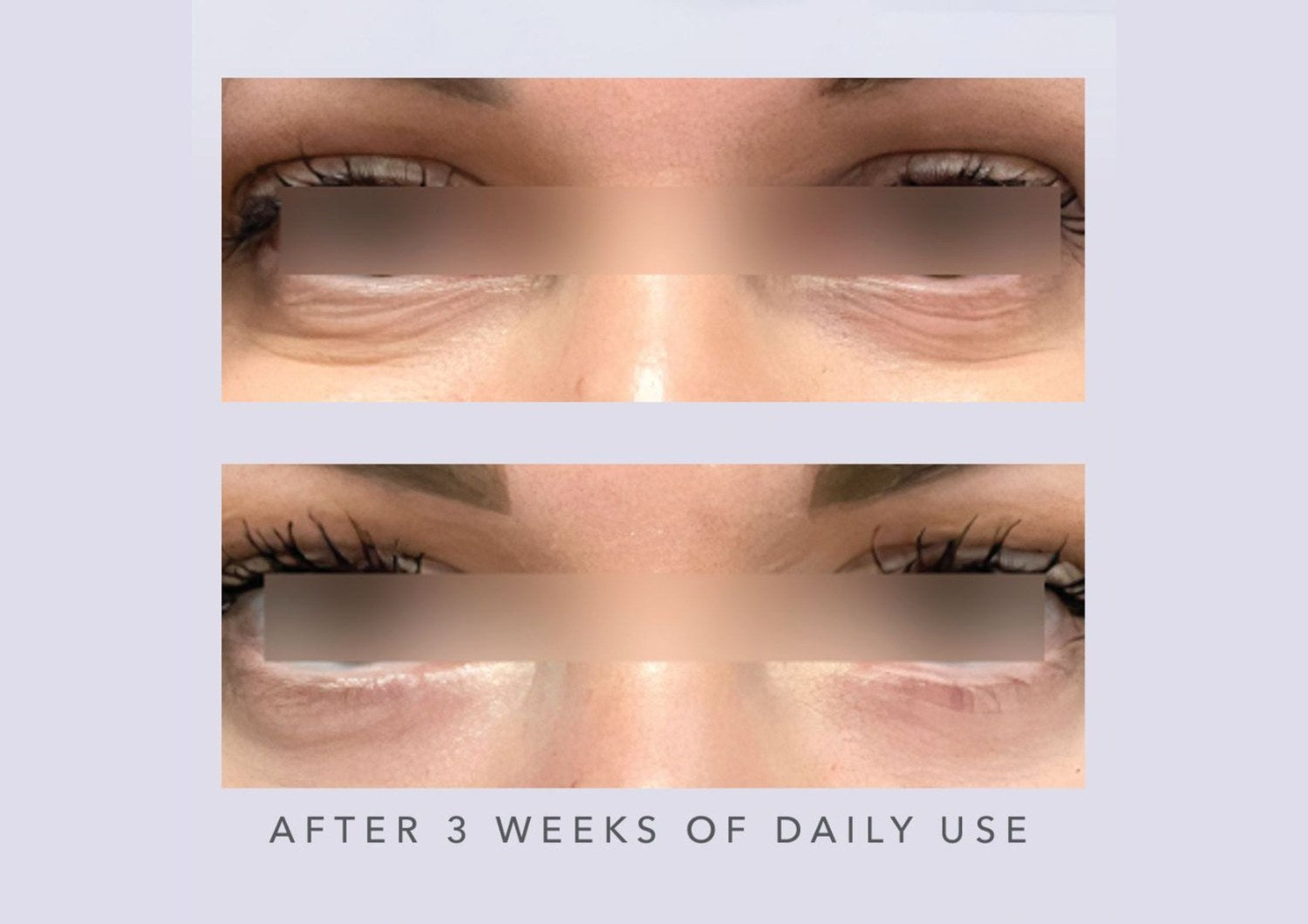 AnteAGE Eye after three weeks of daily use